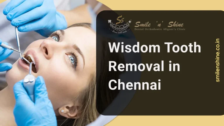 Wisdom Tooth Removal in Chennai