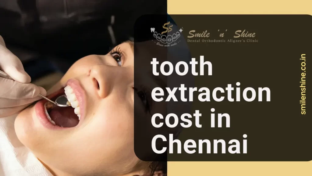 Tooth Extraction Cost in Chennai | SmilenShine
