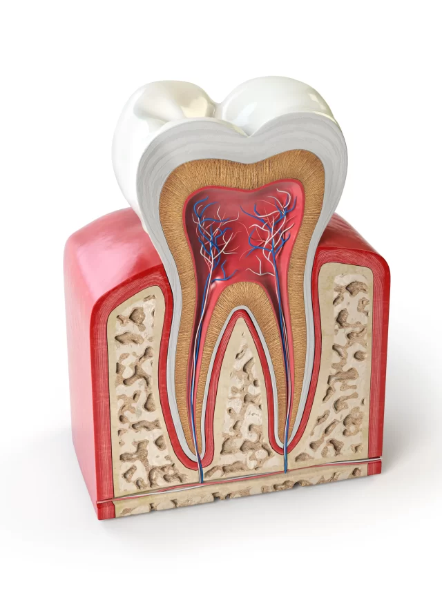 Root Canal Foundation in Chennai