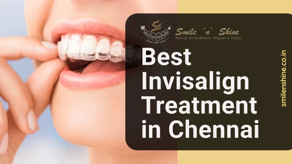 Invisalign Treatment in Chennai
