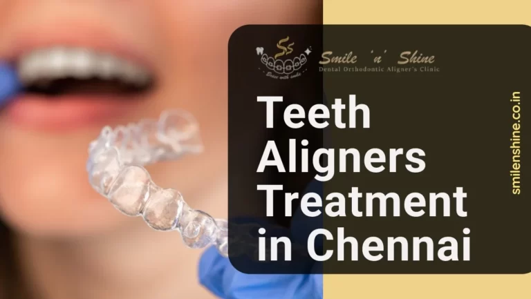 Teeth Aligners Treatment in Chennai