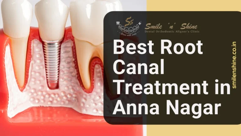 Best Root Canal Treatment in Anna Nagar