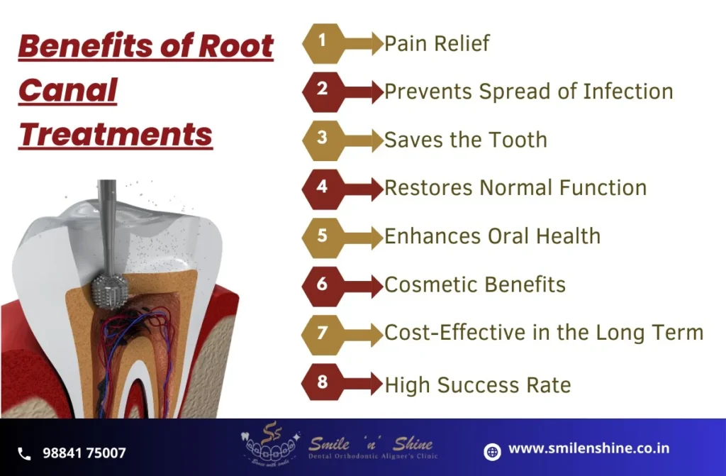 Best Root Canal Treatment in Anna Nagar | SmilenShine