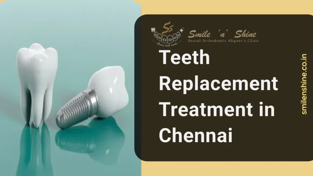 Teeth Replacement Treatment in Chennai