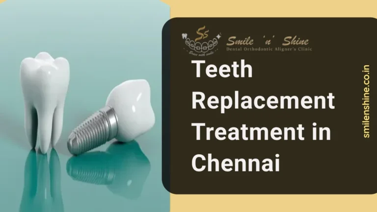 Teeth Replacement Treatment in Chennai