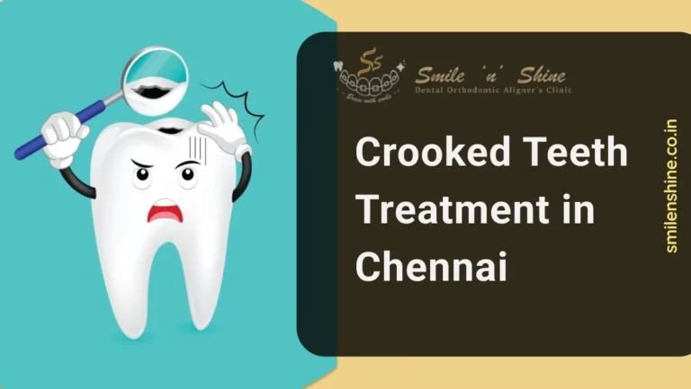 Crooked Teeth Treatment in Chennai