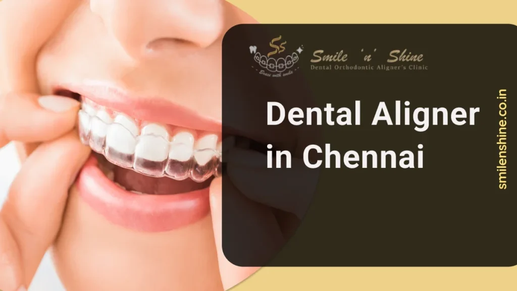 Dental aligner in Chennai