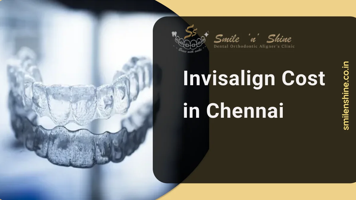 Invisalign cost in Chennai