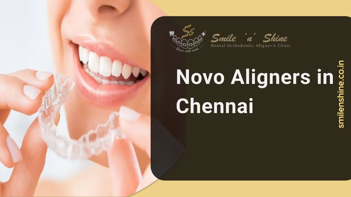 Novo Aligners in Chennai