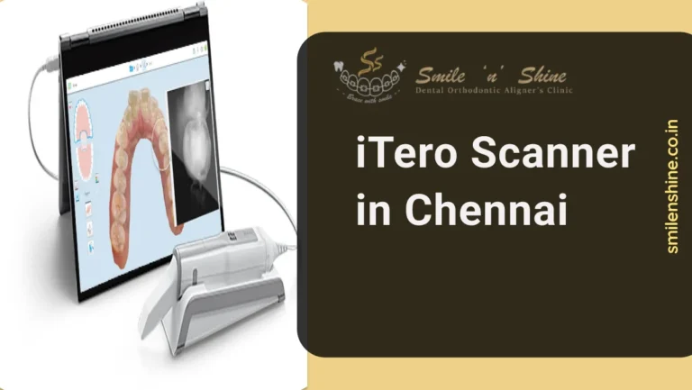 iTero Scanner in Chennai