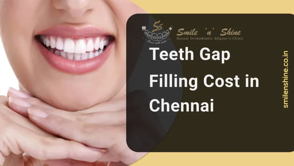 teeth gap filling cost in Chennai