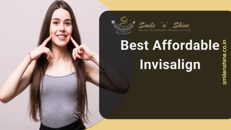 Best affordable Invisalign