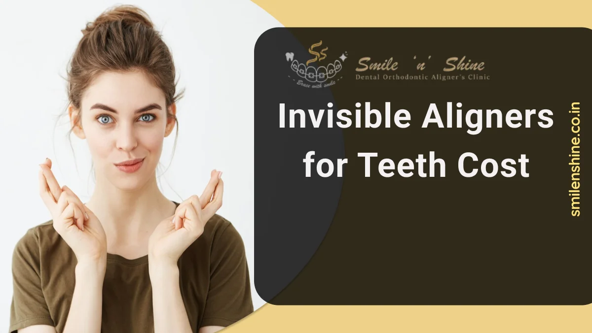 Invisible aligners for teeth cost