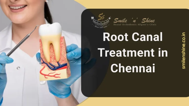 Root Canal Treatment in Chennai