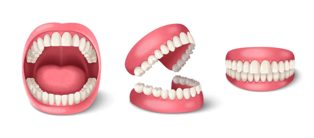 best dentures in Chennai | Smile n Shine