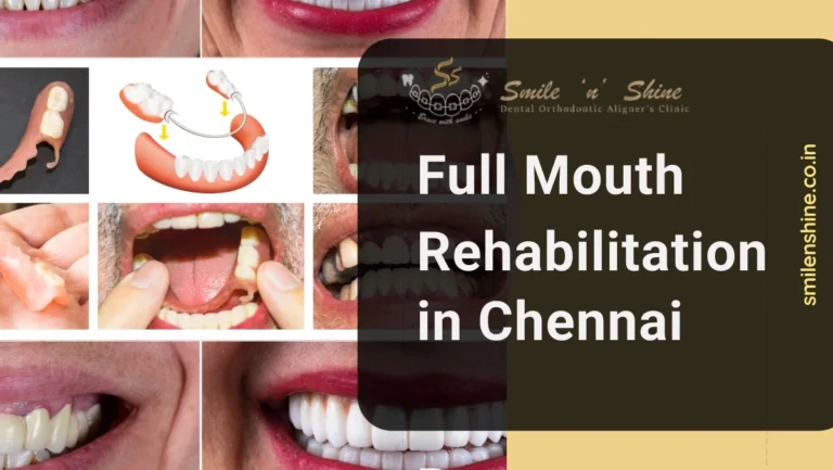 full mouth rehabilitation in chennai