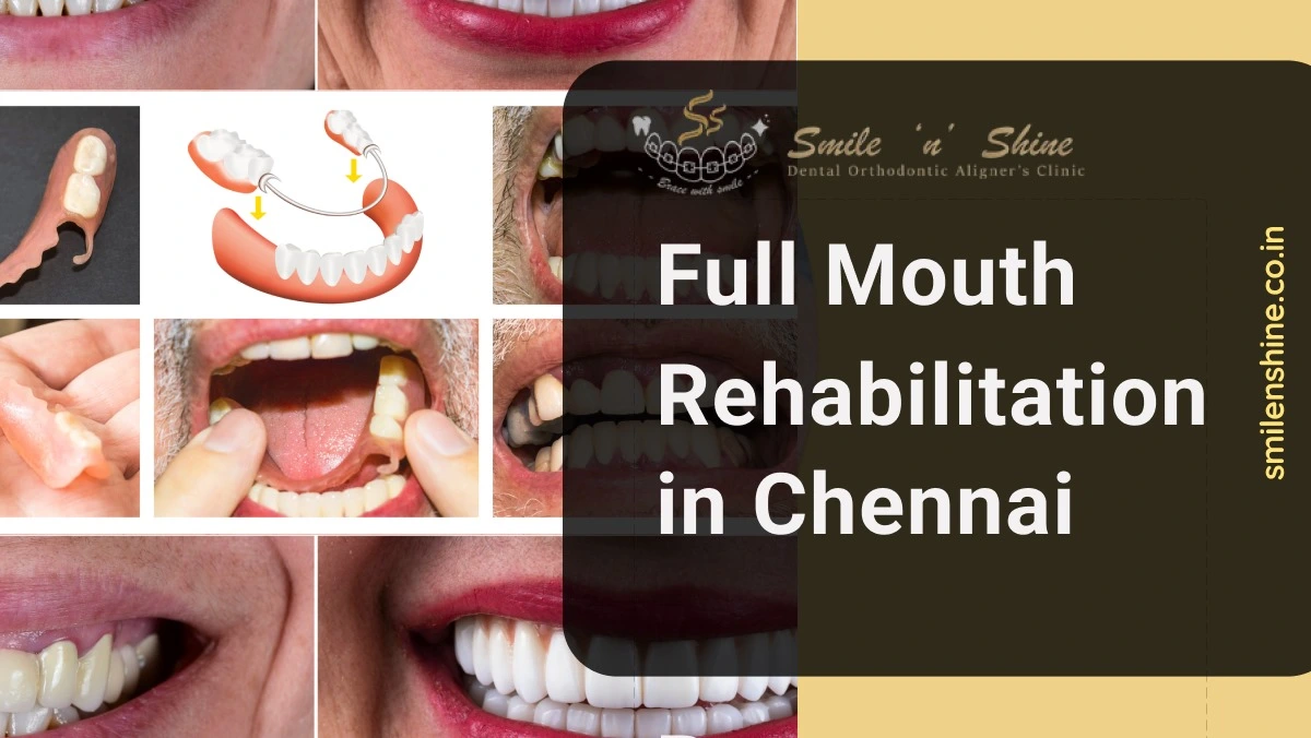 full mouth rehabilitation in chennai